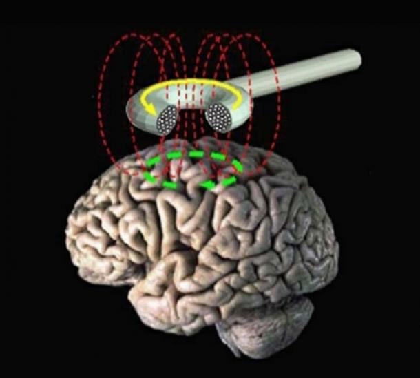 Transcranial magnetic stimulation - schematic diagram. (Eric Wassermann, M.D. / Public Domain)