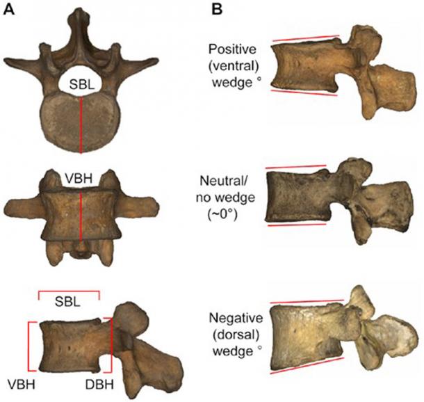Vértebras neandertales y espinas humanas. (Williams et al/PNAS Nexus)