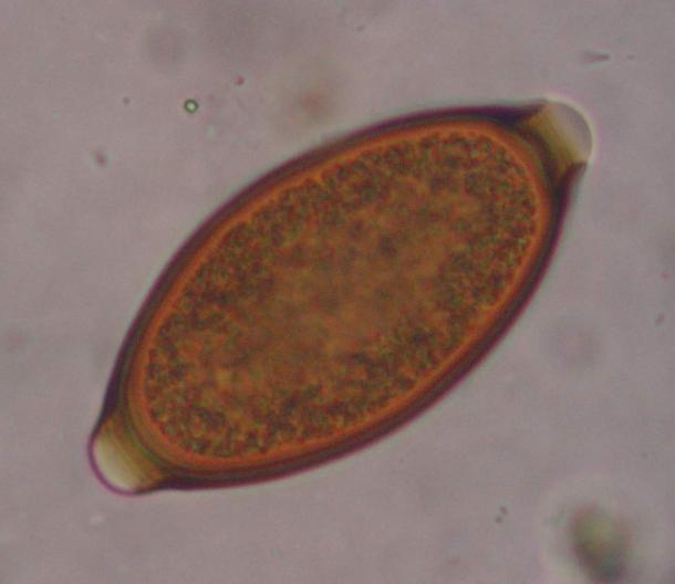 Whipworm egg.