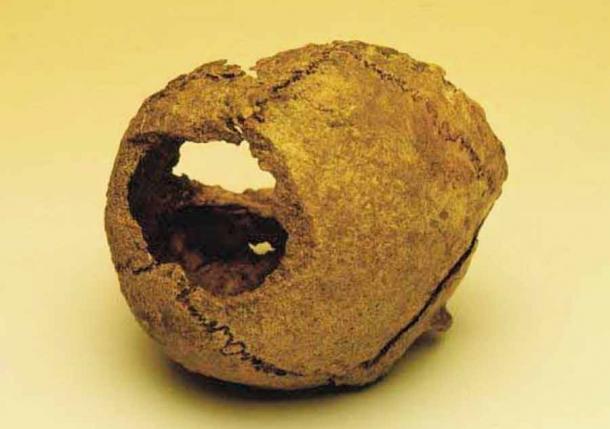 Woman’s Skull from Ballateare burial on the Isle of Man, believed to be the only clear example of a human sacrifice in the British Isles. (Viking Archaeology)