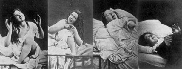 Women under hysteria as depicted in 1880. (Damiens.rf / Public Domain)
