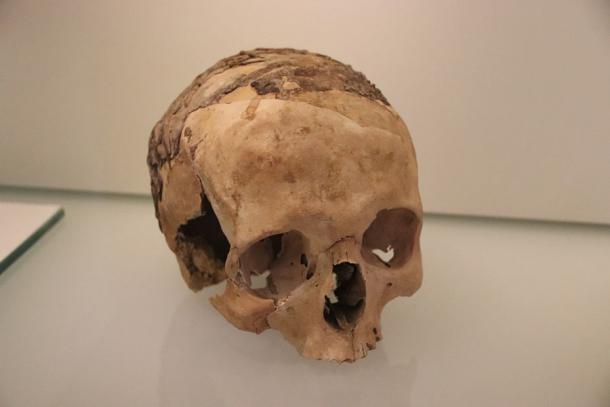 One of the asphalt-coated skulls discovered at Nahal Hemar. (Israel Museum / CC0 1.0)
