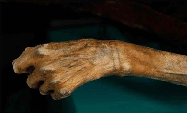 Tattoos on Ötzi the Iceman's wrist. Acupuncturists claim that many of the tattoos correspond to acupuncture points. (Archeological Museum of South Tyrol)
