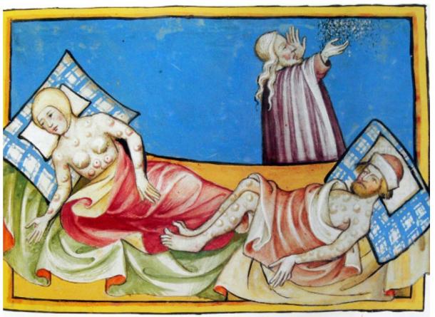 The formation of buboes is one of the main symptoms of bubonic plague. Illustration Toggenburg Bible (1411) 