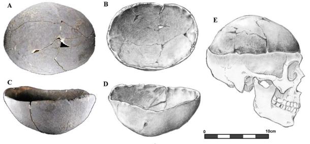 Two of the bodies were buried with calottes or skullcaps 