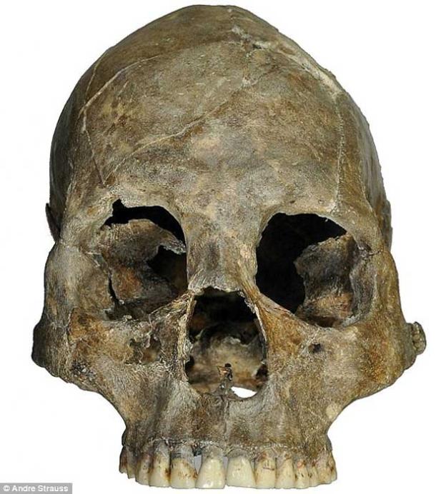 The decapitated skull. 