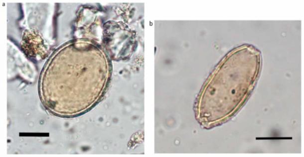 Left: decorticated roundworm egg from burial at All Saints parish cemetery, with dimensions 59 × 45 µm; right: whipworm egg, with dimensions 52 × 24 µm (black bar indicates 20 µm). (Wang, T et al. / Science Direct)