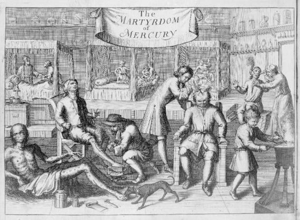Un dibujo de 1709 del tratamiento con mercurio para la sífilis (Colección Wellcome/Dominio público)