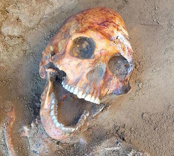 Another burial had an egg-shaped, open mouthed skull
