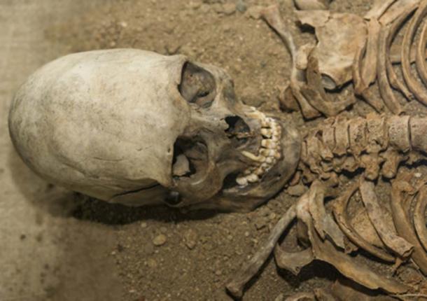 An elongated skull (gerasimov174 / Adobe Stock)