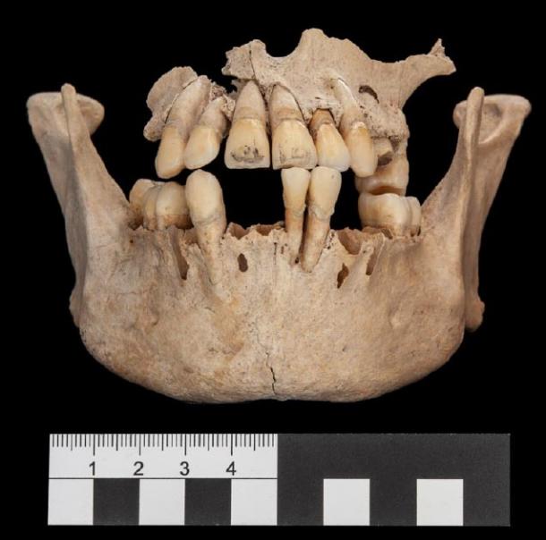 You can see engravings on the front two teeth of this skeleton. (© Nicolaus Seefeld)