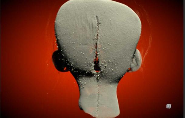 Using existing, non-invasive medical forensic technologies like micro-CT scans the researchers were able to digitally visualization the cuts and stitching on the actual shrunken head artifact. Micro-CT image of the incision at the rear of the skull, windowed and leveled to remove the hair. (Poeta et al. / PLoS ONE)