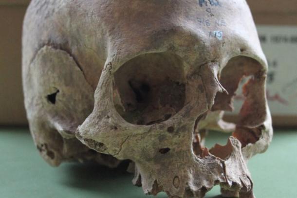 One of the female skulls excavated from the Repton burial site.