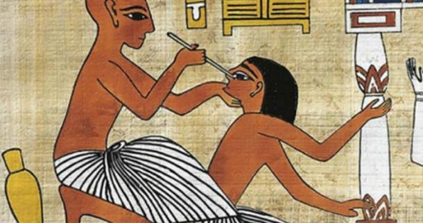 Egyptian fresco showing a doctor performing eye surgery
