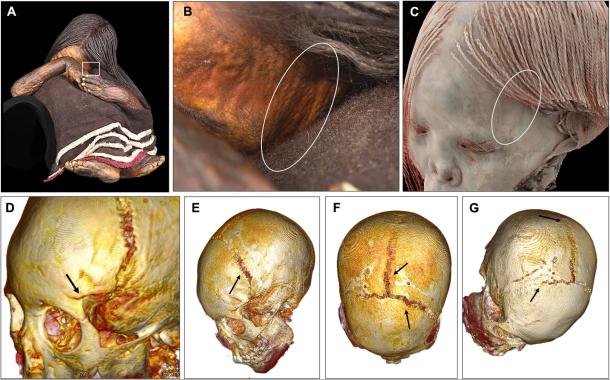 The Final Ascent: New Study Reveals How the Inca Conducted Capacocha Sacrifices