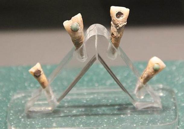 Maya teeth were turned into jeweled teeth by skilled ancient dentists, but a recent study suggests that this also benefited oral hygiene!		Source: Gary Todd / CC0