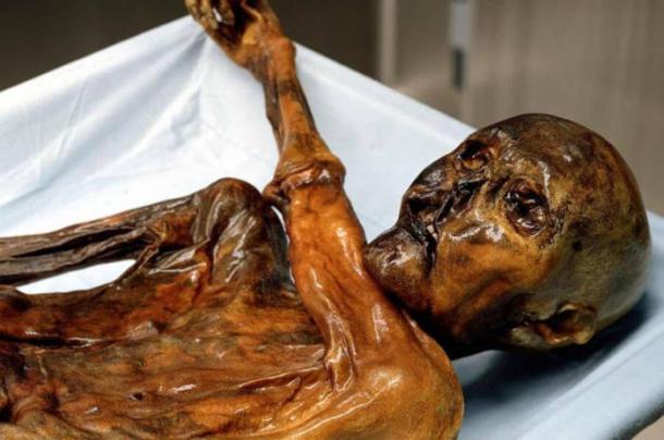 Otzi the Iceman mummy.
