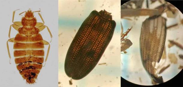 Romans Look to Have Brought Bedbugs to Britain
