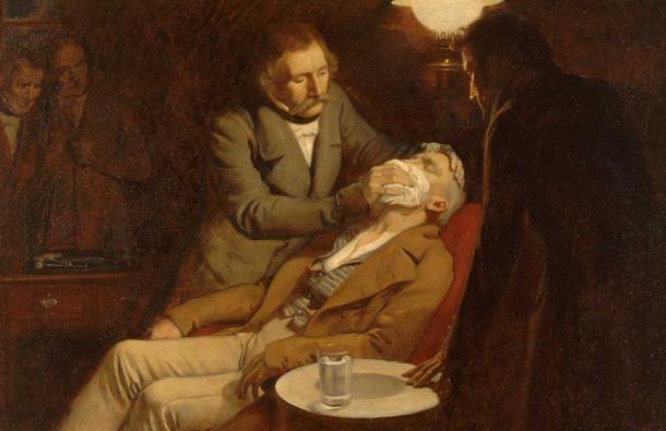 The first use of ether, a surgical anesthetic in dental surgery, oil painting from 1846 by Ernest Board. (Wellcome Images / CC BY 4.0)