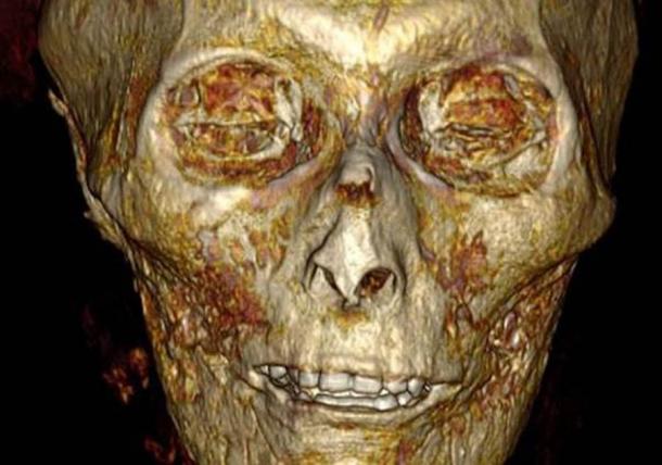 The full facial reconstruction of pharaoh Amenhotep I is eerie and still leaves us wondering what his life really was like and who he really was. ( S. Saleem and Z. Hawass / Frontiers in Medicine)