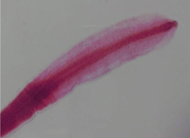 The head of fish tapeworm, Diphyllobothrium latum.