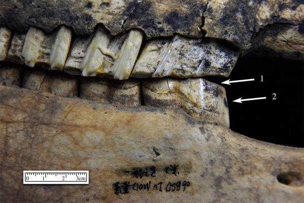 The horse teeth analyzed showed signs of abrasion, consistant with traumatic contact between a bit and the horses teeth. (Yue Li / Northwest University, Shaanxi)