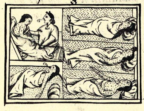 An illustrated panel appearing on fol.54 of Book XII of the ‘Florentine Codex’, the 16th-century compendium of materials and information on Aztec and Nahua history collected by Fray Bernardino de Sahagún. The drawing shows Nahuas infected with smallpox disease. (Public Domain)