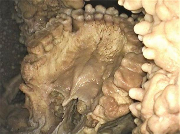 La evidencia forense obtenida de la boca de Altamura Man mostró que tenía cálculos dentales y padecía enfermedad de las encías. (Universidad Sapienza de Roma)