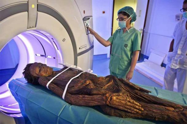 La momia ingresa al escáner para una tomografía axial computarizada en el Hospital Quirón de Madrid.  (Imagen: proporcionada por el autor. Hospital Quirón)