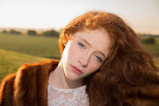 Ireland has the highest concentration of red-haired genes in the world. (Pixabay License)