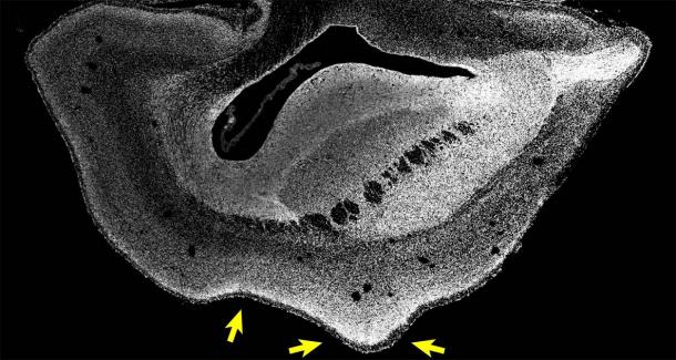 Imagen microscópica de una sección de un hemisferio cerebral de un feto de tití transgénico ARHGAP11B de 101 días. Los núcleos celulares se visualizan mediante DAPI (blanco). Las flechas apuntan a un nuevo pliegue en el cerebro del mono. (Heide et al. / MPI-CBG)