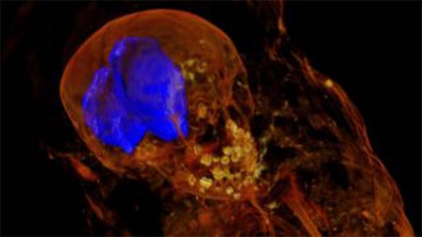 X-ray diffraction showed the little girl mummy's unerupted adult teeth and a mass of resin inside her skull. (Stuart R. Stock)