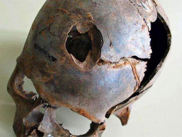 One of the skulls found at Europe's oldest massacre site in Germany.  Notice how the skull was knocked in, probably with a fatal wooden club.  (State Office for Culture and Monument Preservation Mecklenburg-Western Pomerania)