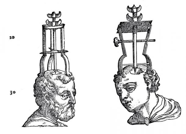 Two heads with trephining instruments in position. (Wellcome Images / CC BY 4.0) 