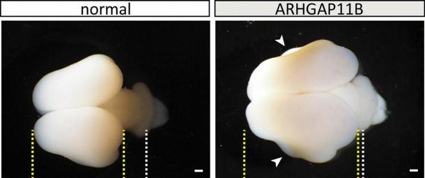 Wild-type (normal) and ARHGAP11B transgenic (101 days) marmoset brains.  Yellow lines, boundaries of the cerebral cortex;  white lines, development of the cerebellum;  arrowheads, folds.  Scale bars, 1 mm.  (Heide et al. / MPI-CBG)