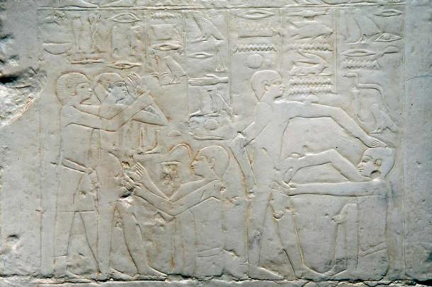 The only image found to date which shows ancient Egyptian surgery in action depicts a circumcision. Plaster copy of bas relief dating back to 2500 BC discovered at Sakkara in Egypt showing a circumcision. (Wellcome Collection / CC BY 4.0)