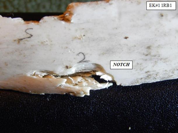 A new category of incisal dentition signature termed a Notch. 