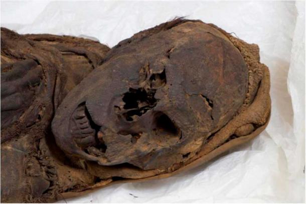 The Delémont male mummy: view of the face and aspects of the upper body half from the right side. (Begerock et al. 2022/ Frontiers in Medicine)