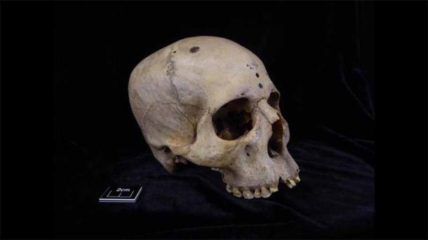 Skull and mandible 236, dating from between 2687 and 2345 BC, belonged to a male individual aged 30 to 35. (Tondini, Isidro, Camarós, 2024/Frontiers)