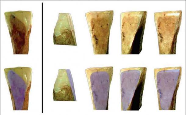 These wear marks to the lower incisor of one of the individuals suggest long term wearing of a labret below the lower lip (Boncuklu Tarla Excavation Archive)