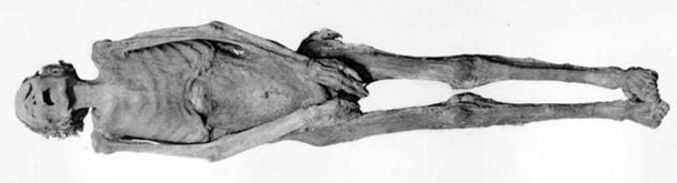The mummy of Unknown Man E (“The Screaming Mummy”)