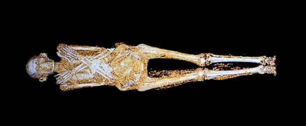 A CT (computerized tomography) scan of a 2,200-year-old Egyptian mummy on display in the Israel Museum in Jerusalem.