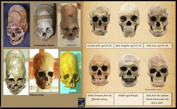 Paracas skulls (left) and modern human skulls (right)