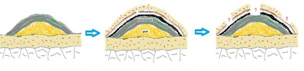 Fig.7: The seemingly ever-more perplexing steps. Mounds upon mounds, and then pits dug in and backfilled.