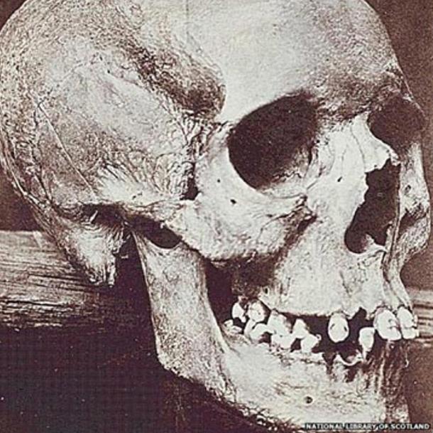 A photo of the skull of Lilias Adie