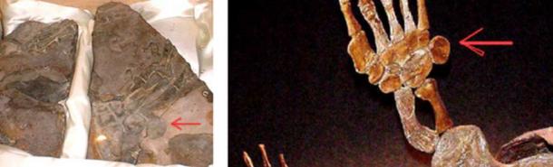 The pisiforms on the fossil are circular and protrude. Human pisiforms don't protrude.