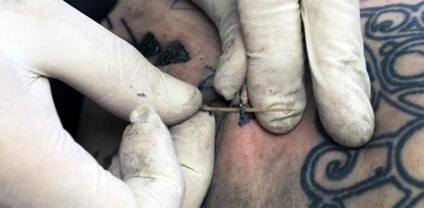 This “hand poking” technique, resulting in a distinctive pattern, is believed to have been used by Ötzi to apply his tattoos (Deter-Wolf et al., Exarc, 2022)