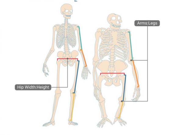 The researchers found that individuals with a higher ratio of hip width to height were more likely to develop hip osteoarthritis; people with a higher ratio of femur length to height were more likely to develop arthritis in the knees; and those with a higher ratio of torso length to height were more likely to develop back pain. (Illustration was created with BioRender.com., Kun, E et al/ Science)