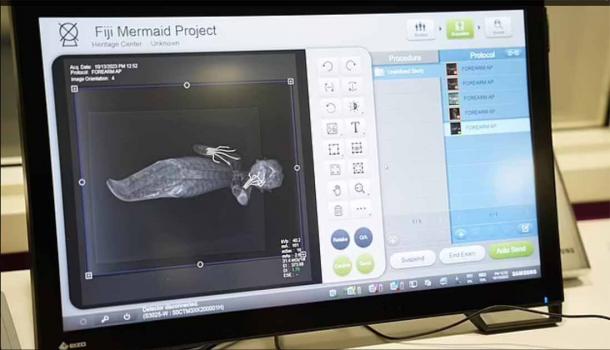 CT scanning procedure used on the Fiji mermaid will to reveal new findings. (Norse Media)