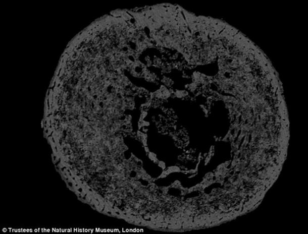 The scans showed that most of the bones were undamaged. A few weeks into a child's life, gut bacteria begin to form, which will damage bones after death in a process called bioerosion. The fact that the bones were undamaged suggests they belonged to stillborns.